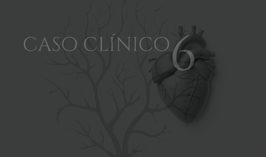 Hipertensión arterial resistente